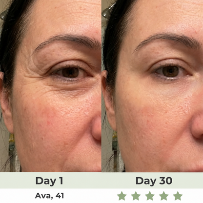 Perspa 7-in-1 LED Facial Sculptor