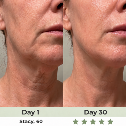 Perspa 7-in-1 LED Facial Sculptor